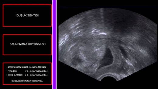 5 Haftalık Gebelikte Kanama Belirtileri ve Tedavisi