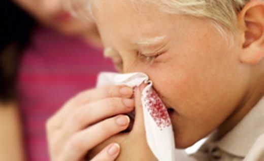Burun Kanamasında İlk Yardım Nasıl Yapılır?