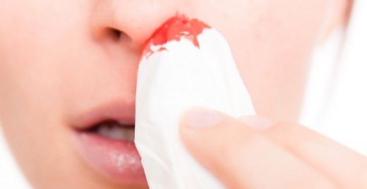 Çocuklarda Burun Kanaması Nedenleri