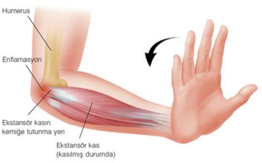 Diş Çekiminden Sonra Kanama Nasıl Durdurulur?