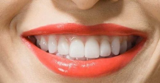 Diş Kanamasına Ne İyi Gelir?