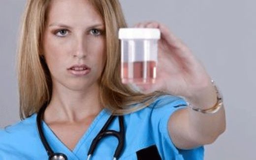 İdrar Yolu Kanaması Belirtileri ve Tedavisi