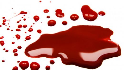 Çeşitli Kanama Tipleri