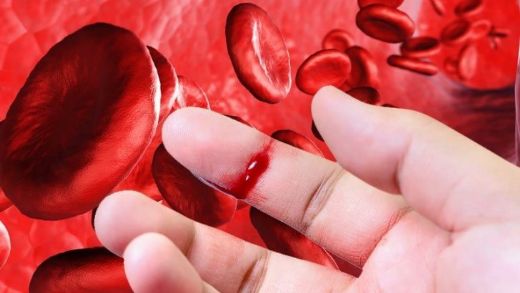 Kanama Riski Hemşirelik Bakım Planı