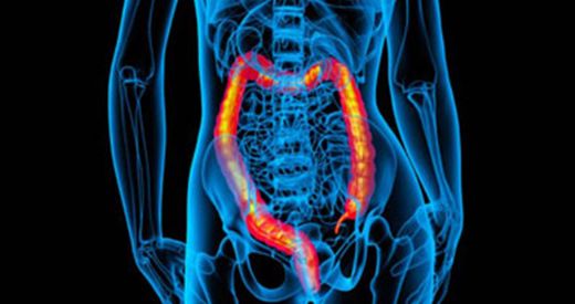 Rektal Kanama Nedenleri