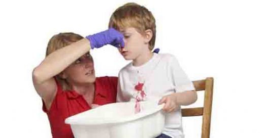 Sabahları Burun Kanaması Belirtileri ve Tedavisi