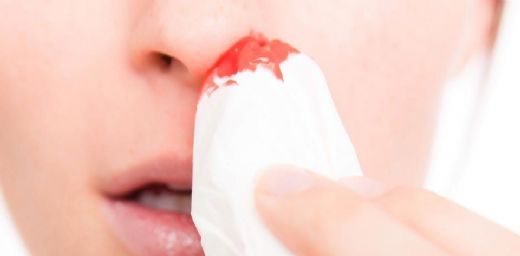 Sağ Burun Kanaması Belirtileri ve Tedavisi